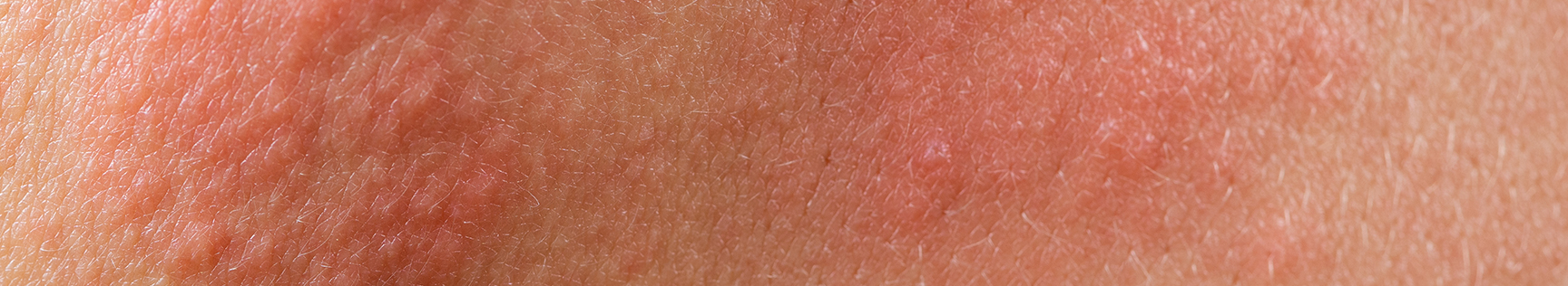 banner img