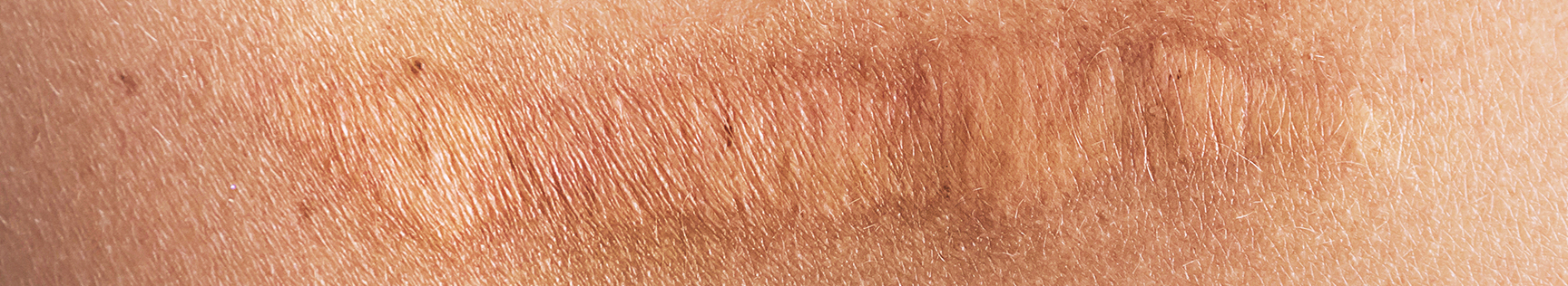 banner img