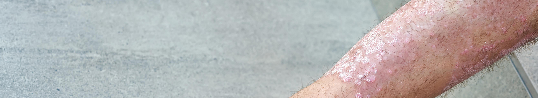 banner img