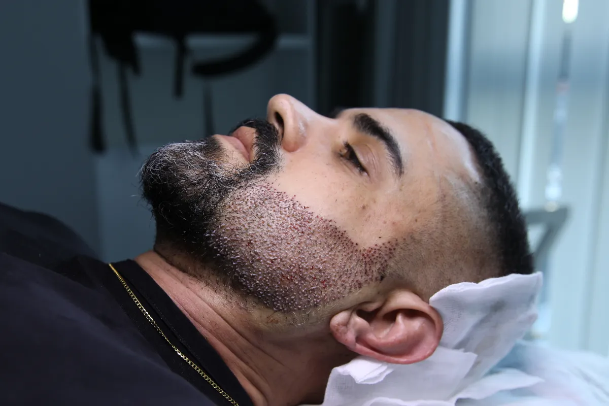 Soqol Ko'chirib O'tkazish