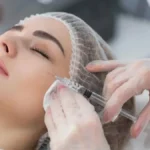 Botox ta'siri qancha vaqt davom etadi va nima ta'sir qiladi