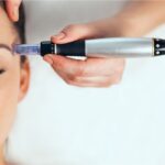 Dermapen Nima: Ishlash printsipi, protsedura bosqichlari va natijalari 2026